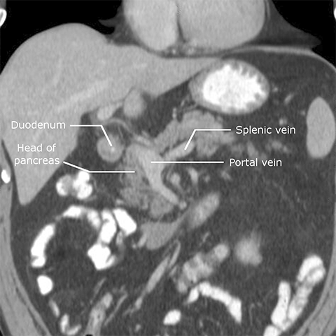 Index of /dept/radiology/radiologysite/images/Med students 7, pancreas